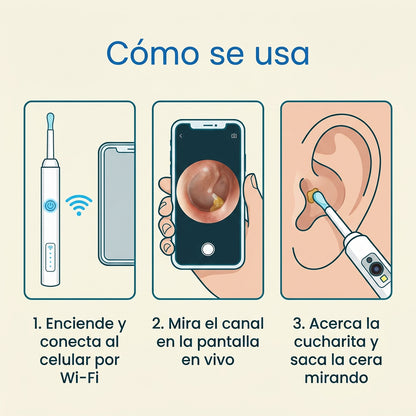 OTOSCOPIO - Limpiador de oídos con cámara HD